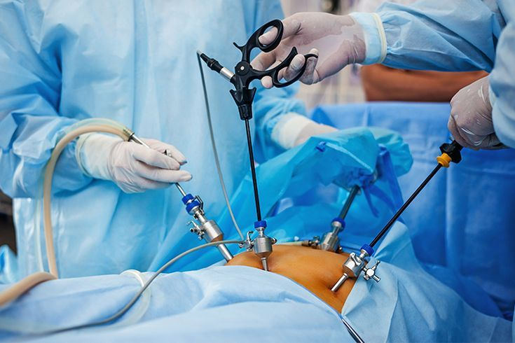 Laparoscopic Surgery department
